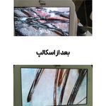 مرکزتخصصی رنگ،درمان،اسکالپ عارفه باقری