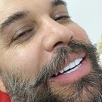 کامپوزیت ونیر