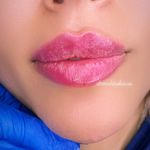 مطب زیبایی دکتر مهسا کاوئی