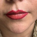 کلینیک زیبایی آفرینش،دکتر مهدی قهرمانیان