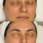 ماساژ فیشال و هد اسپای تاج محل (بانوان)