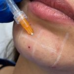 مطب زیبایی و پوست روشنا