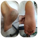 کفسابی و پدولوژی ناخن خانمها و آقایان