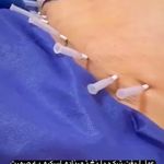 متخصص طب سوزنی و سنتی دکتر لیلی حمیدنیا