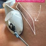 کیلینیک زیبایی و لیزر ژامک