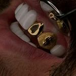 کامپوزیت لایرینگ و دندانسازی دکتر صفری