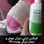 فشیال و خدمات پوستی