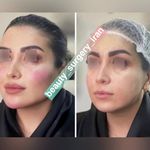 دکتر محمود قهقایی فوق تخصص جراحی پلاستیک