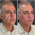 مجموعه لیزر و زیبایی کارنا(شاتی نداریم)