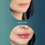 کلینیک درمانی زیبایی آینا