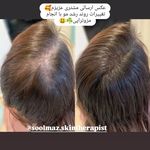 خدمات فیشال و پاکسازی و درمانی پوست