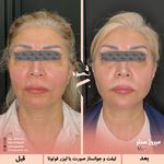 مرکز پزشکی و زیبایی میروژ سنتر