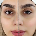 اکستنشن مژه ولیفت مژه ابروسمانه شاطرزاده