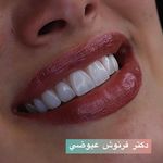 مركز دندانپزشکی دکترفرنوش عیوضی