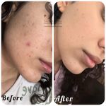 خدمات تخصصی فیشال سارا اسکین بار