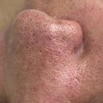 پاکسازی پوست و مو مهسام