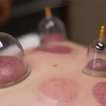 حجامت و فصد مشاوره طب الرضا