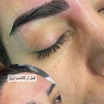 کلینیک زیبایی پوست و مو آتریسا
