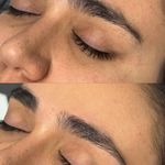 خدمات درماپلنینگ vip با اصلاح ابروی رایگان