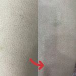 خدمات تخصصی پوست (فیشیالیست رویا صالحی)