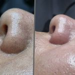 خدمات تخصصی پاکسازی پوست سحر