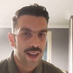 بهترین دکتر کاشت مو در بندرعباس، فاطمه سینایی