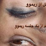 مرکز زیبایی نصیر