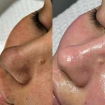 مژگان اسکین کرMojgan skincare