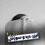 لیزر خورشید