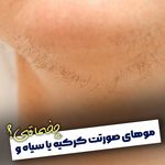 لیزر خورشید