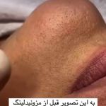 سالن زیبایی گلباز بیوتی بار