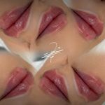 مطب پوست زيبايی ليزر دکتر شاه نعمت الهی