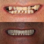 دنداپزشکی دکتر یاشار معزز