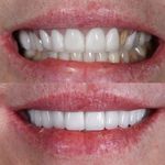 کلینیک تخصصی دندانپزشکی و ایمپلنت الین