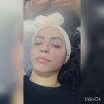 جشنواره بزرگ پلاسما تراپی و میکرو نیدلینگ تا پایان بهمن ماه