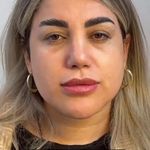 کلینیک زیبایی شایلی