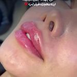 کلینیک زیبایی شایلی