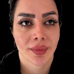 کلینیک زیبایی شایلی