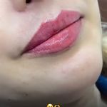 کلینیک زیبایی شایلی