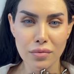 کلینیک زیبایی شایلی