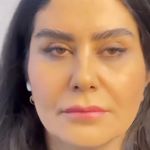 کلینیک زیبایی شایلی