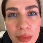 کلینیک زیبایی شایلی