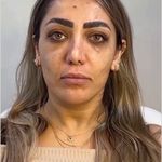 کلینیک زیبایی شایلی