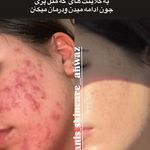 خانه پوست و زیبایی انیس - اهواز - 5709