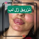 کلینیک پوست مو زیبایی و لیزر ثمین