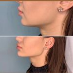 کلینیک پوست و زیبایی ژیلاوَش