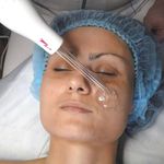 پاکسازی و فشیال تخصصی پوست فاطمه توکلی