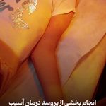 فیزیوتراپی تهرانسر(۱۰۰٪رضایت مراجعین)