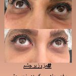 کلینیک پوست و مو و لیزر نیلوفر آبی