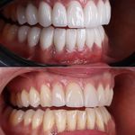 دندانپزشکی دکتر هومن باقری (بیمه نداریم)